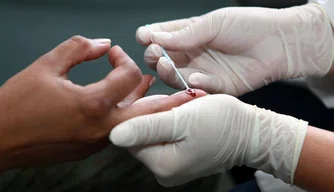 Teste rápido de HIV
