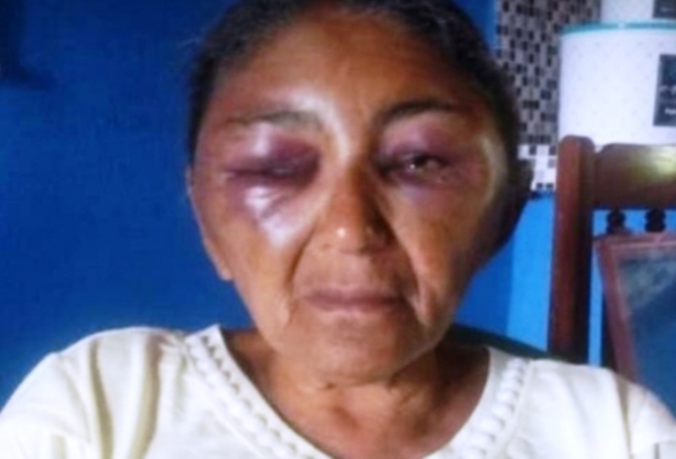 Maria das Dores Silva, de 62 anos, agredida pelo filho na cidade de Assunção do Piauí