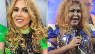 Cantora Joelma cancela shows após diagnóstico de esofagite, gastrite e edema
