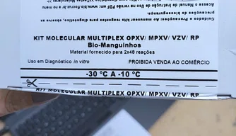 Piauí recebe 400 kits de testes para Mpox do Ministério de Saúde