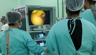 Hospital de Luzilândia realizou 287 cirurgias em maio.