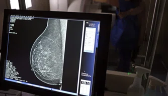 Teste de mamografia
