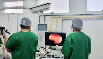 endoscopia, saúde, exame, rede municipal