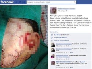 Suposta foto da vítima foi postada por agressora em uma rede social(Imagem:Reprodução/Facebook)