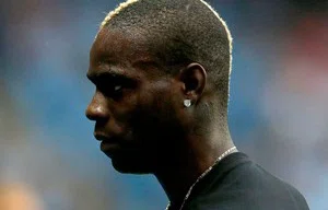 Balotelli vai para a mesa de cirurgia para corrigir problema nos olhos