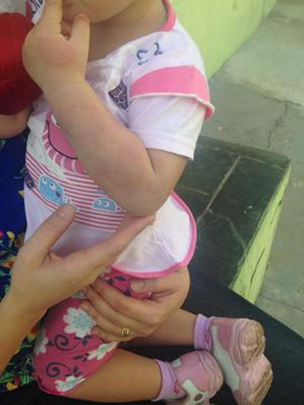 Dona da creche pode ser indiciada por les&atilde;o corporal culposa, quando n&atilde;o h&aacute; inten&ccedil;&atilde;o(Imagem:reprodu&ccedil;&atilde;o)