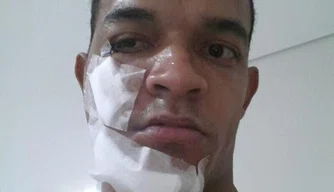 Jheimy aparece com o rosto com curativos