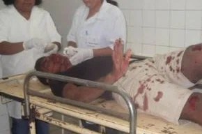 Jovem sofre acidente