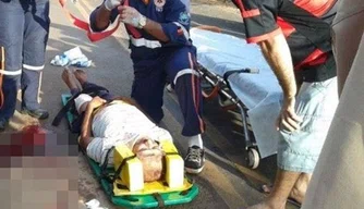 Lavrador ficou gravemente ferido