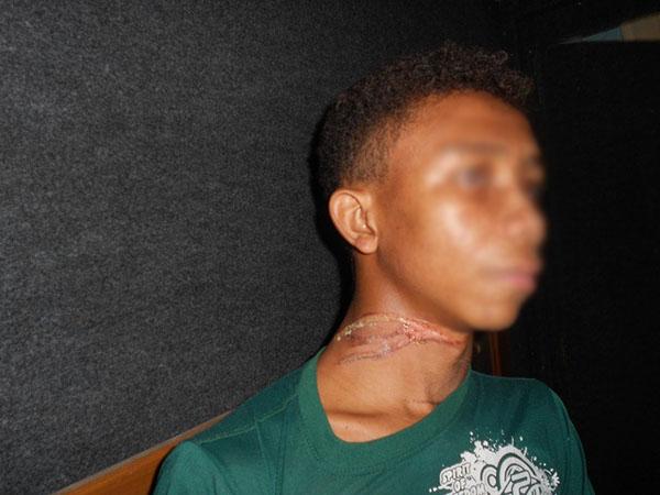 Matias da Concei&ccedil;&atilde;o Silva, de 17 anos(Imagem:Clicaesperantina)